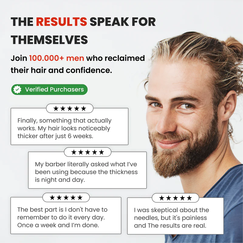 AlphaInfuse™ Hair Regrowth System