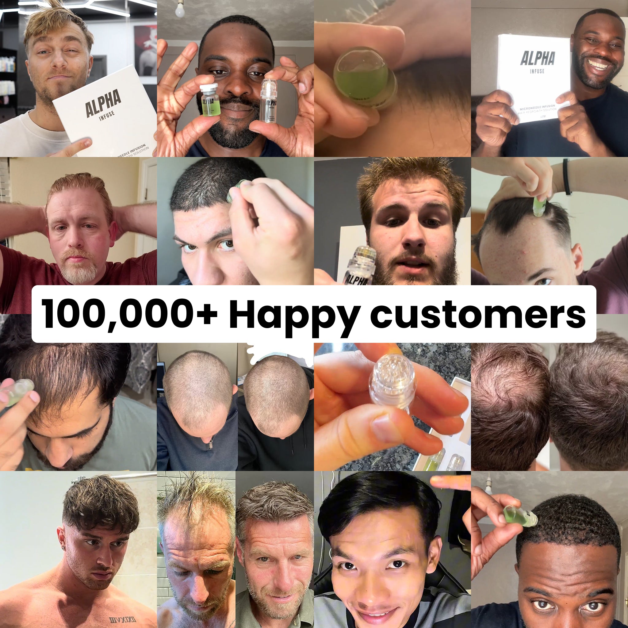 TEST - AlphaInfuse™ Hair Regrowth System