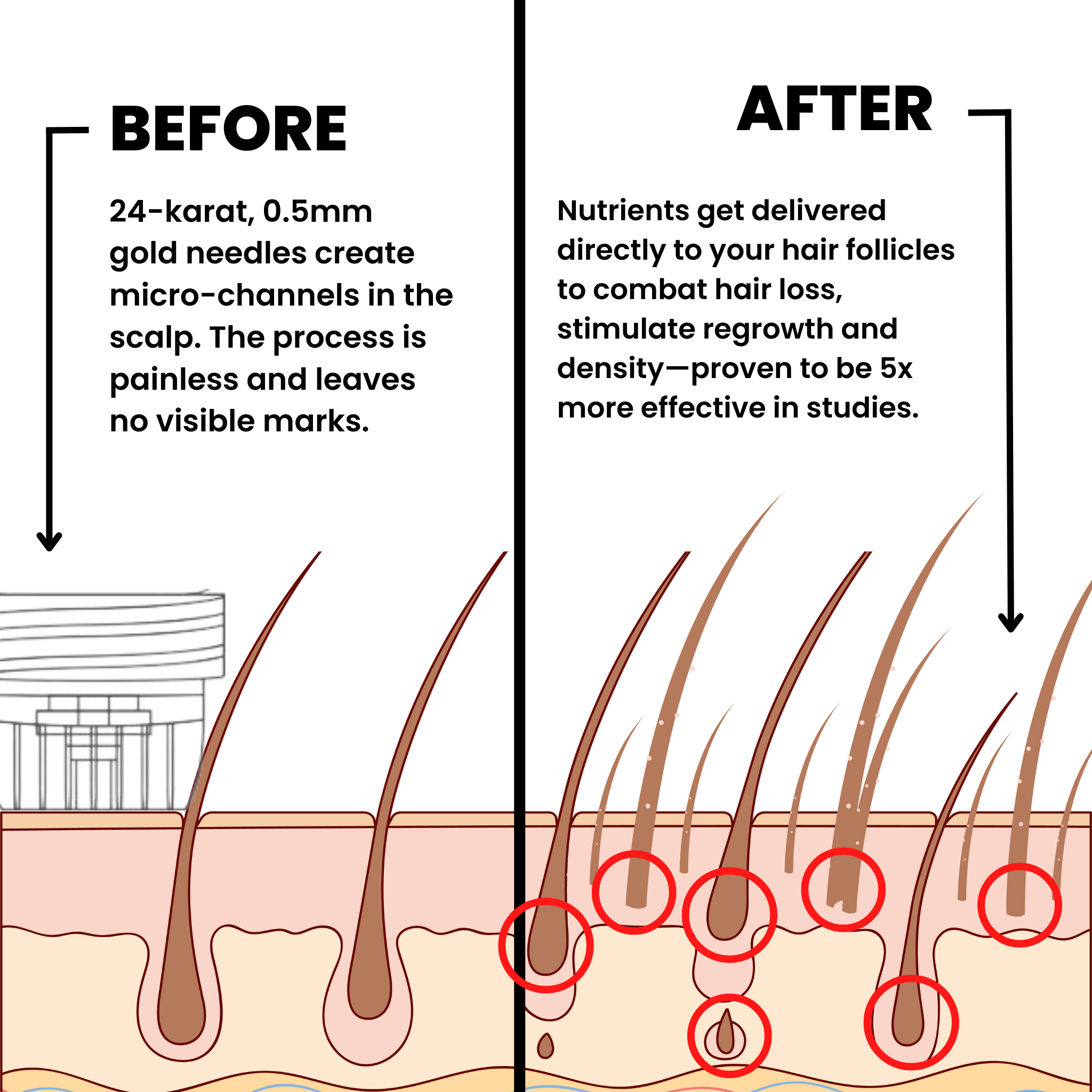 AlphaInfuseβ’ Hair Regrowth System