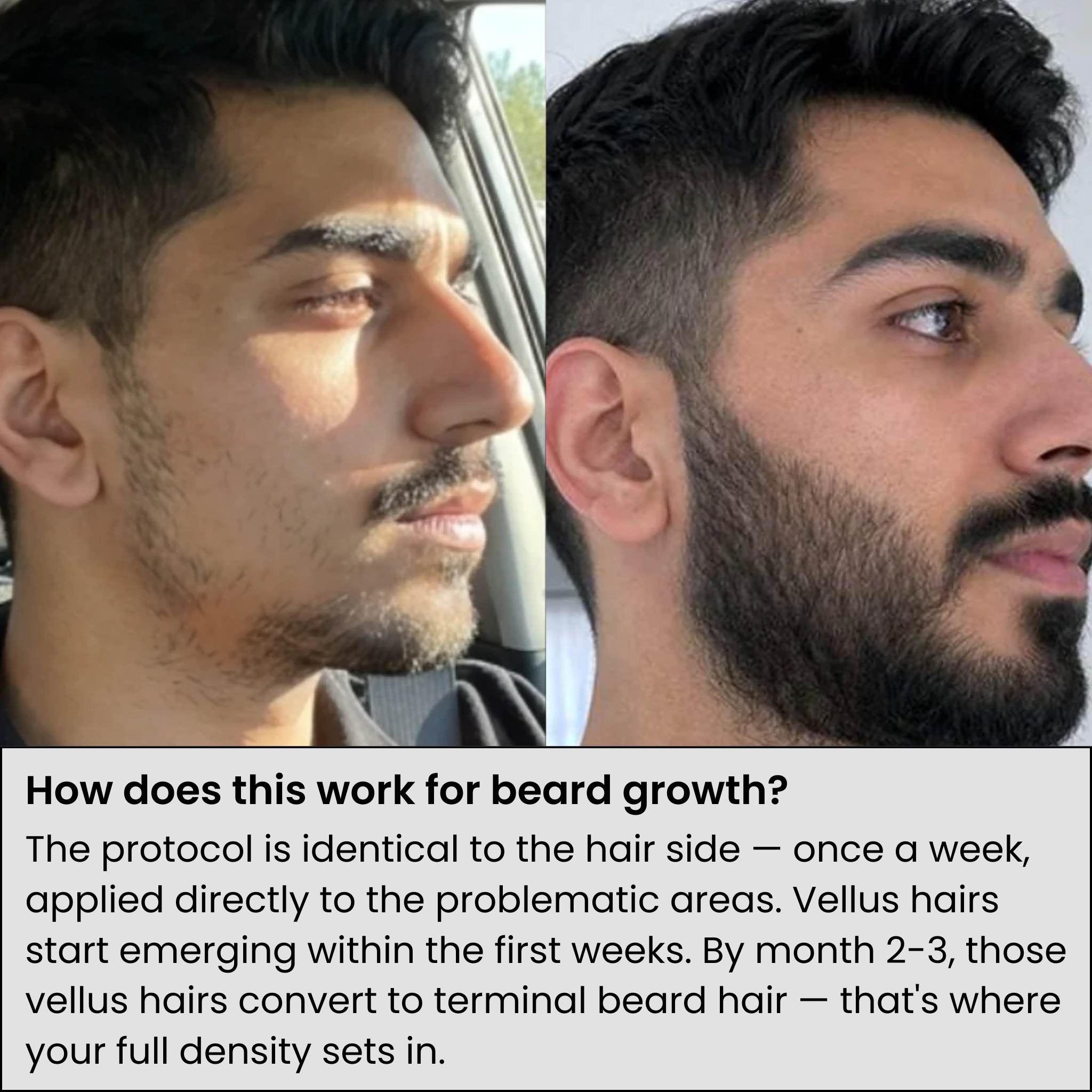 AlphaInfuseβ’ Hair Growth System