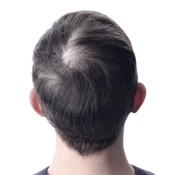 Hair scalp care application