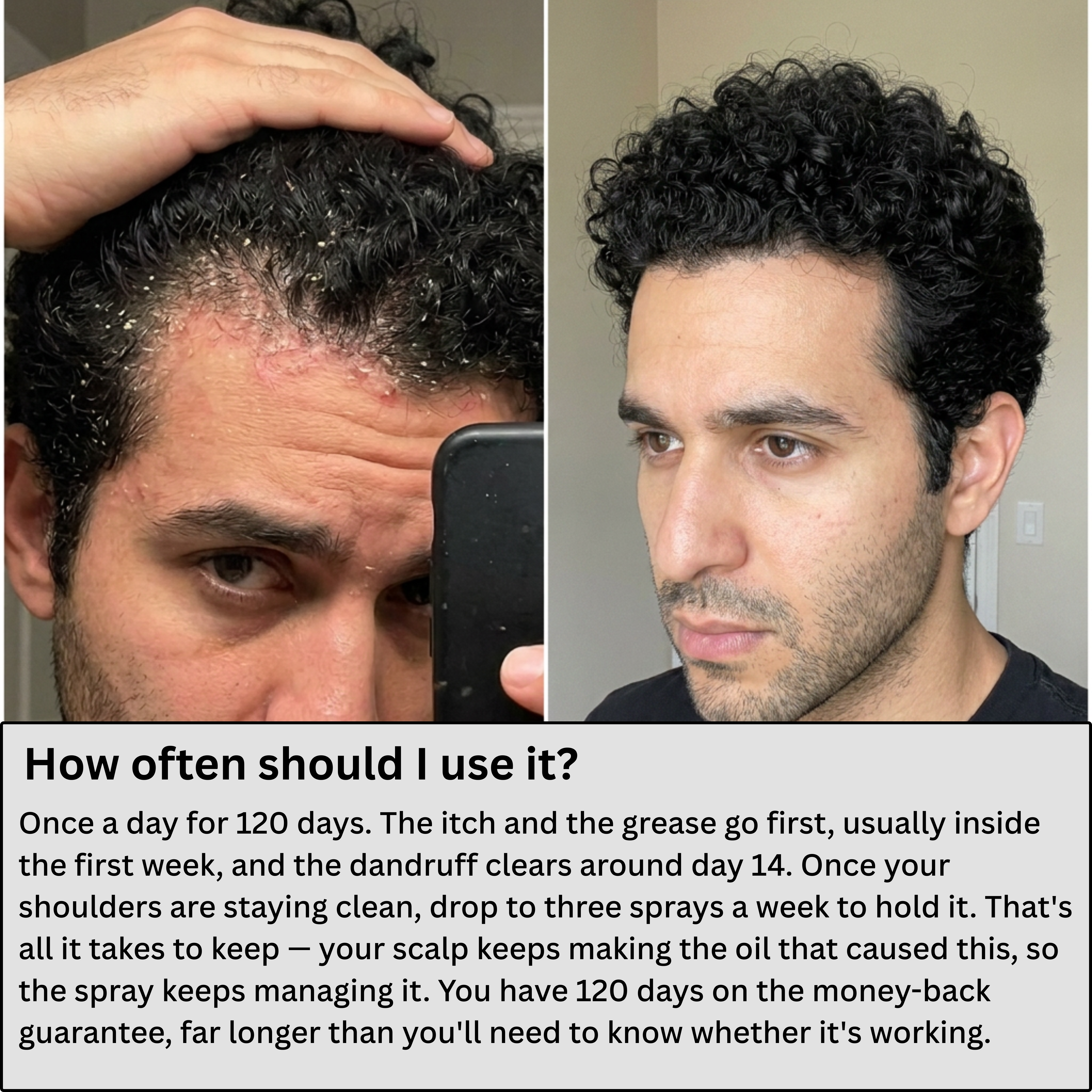 AlphaInfuse™ Ultimate Scalp Recovery Spray