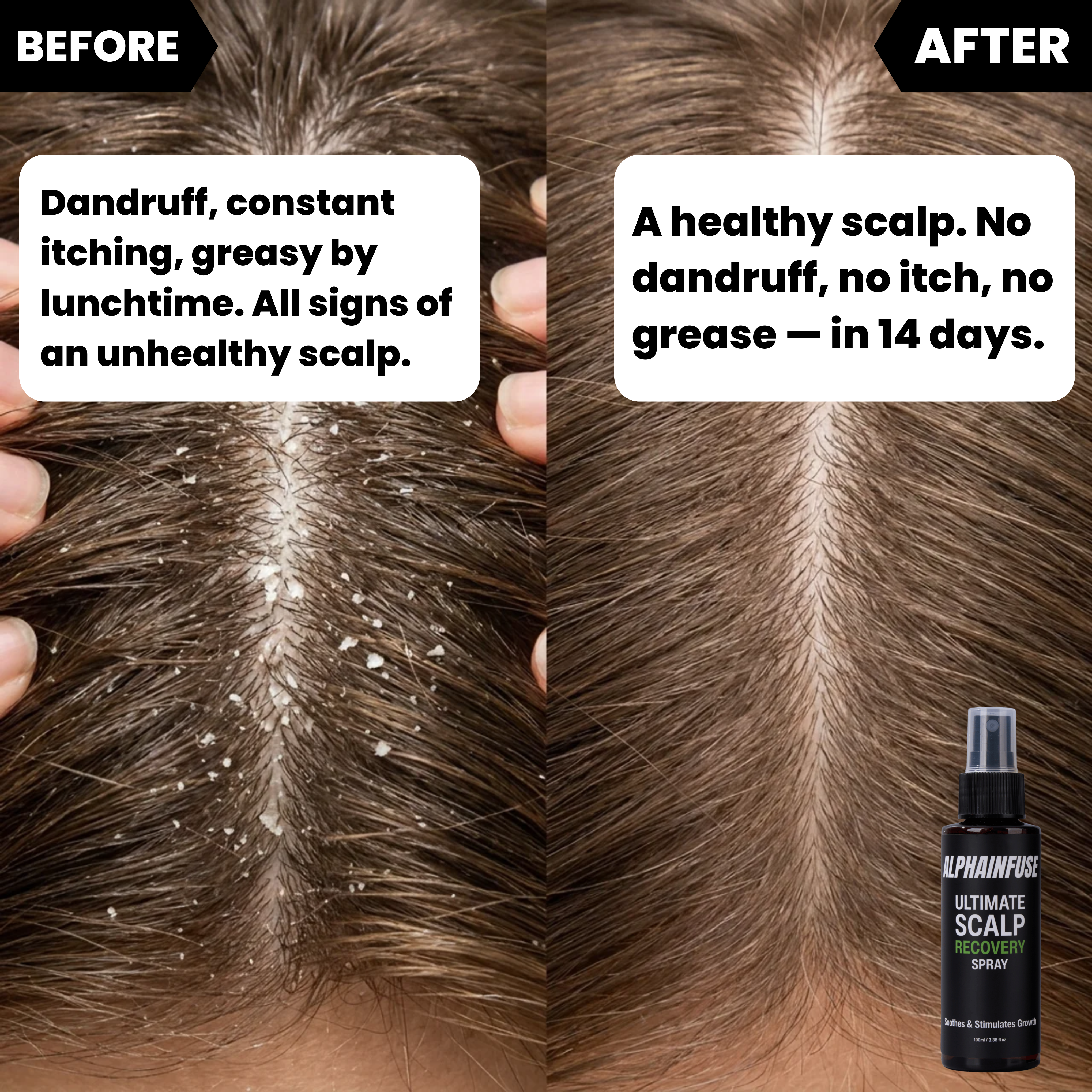 AlphaInfuse™ Ultimate Scalp Recovery Spray