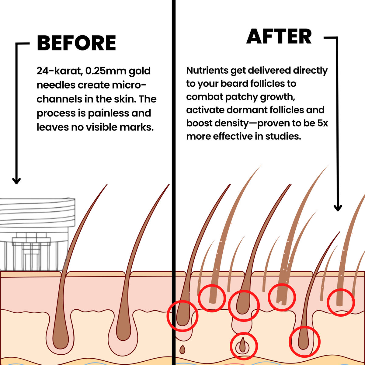 AlphaInfuse™ Beard Growth System