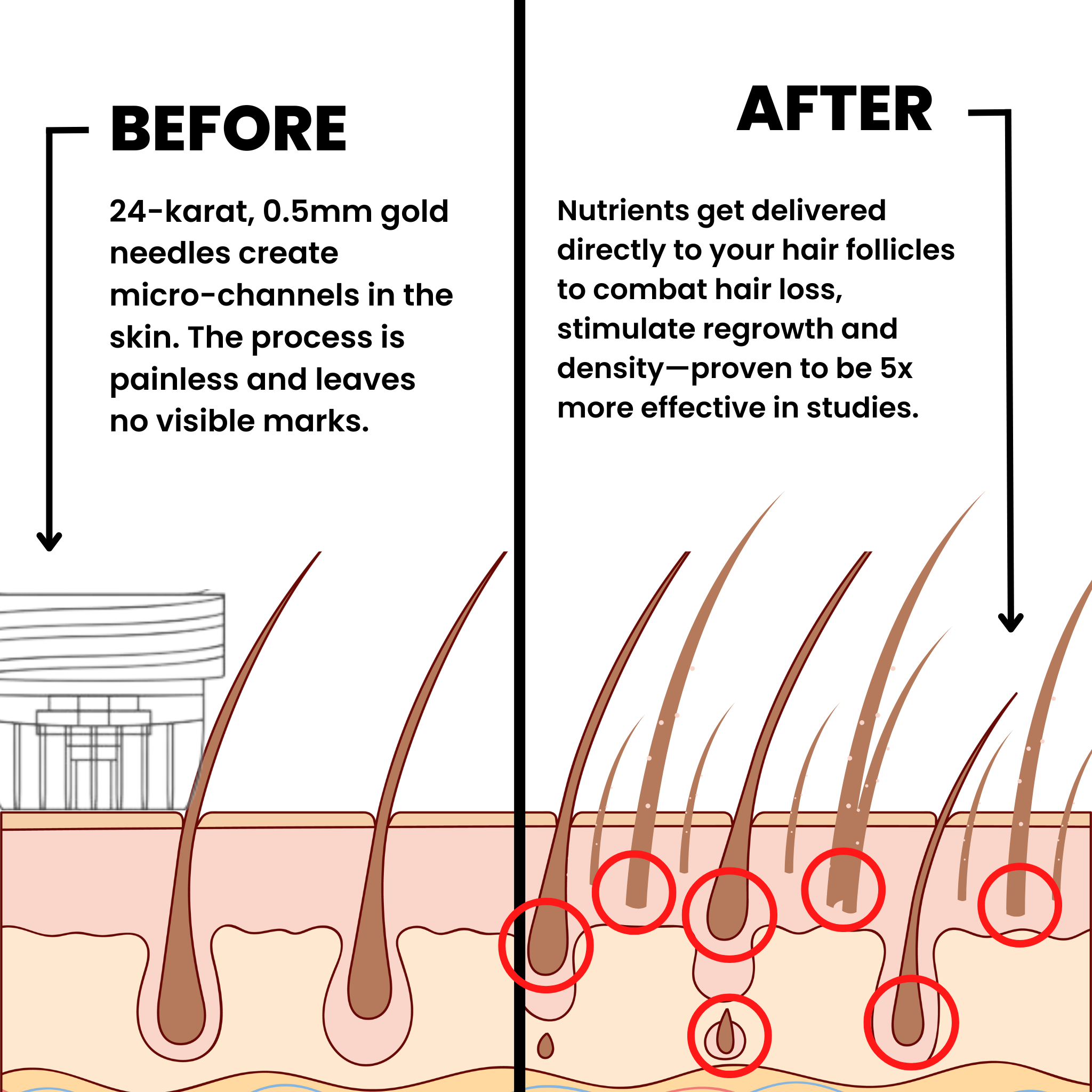 AlphaInfuse™ Hair Growth System